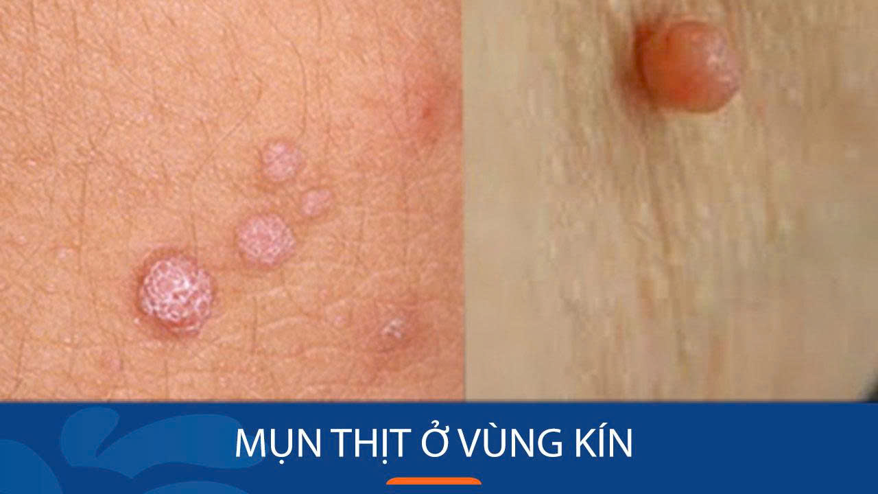 Hình ảnh minh họa